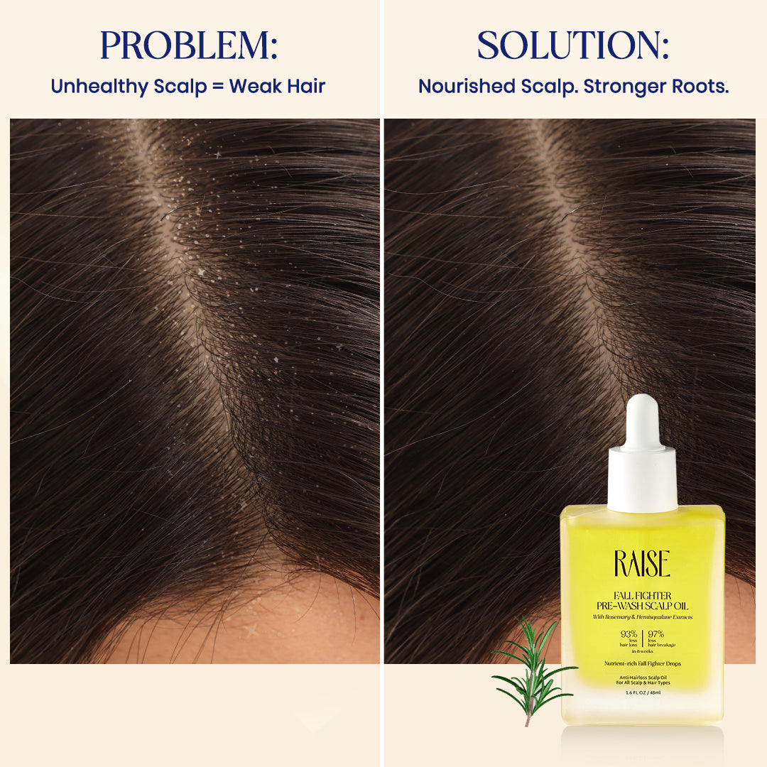 Fall Fighter Pre-Wash Scalp Oil (48ml) | Anti-Hair Loss Scalp Oil