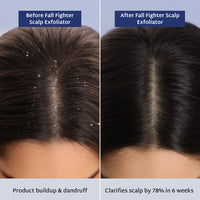 Raise Fall Fighter Scalp Exfoliator For Dandruff