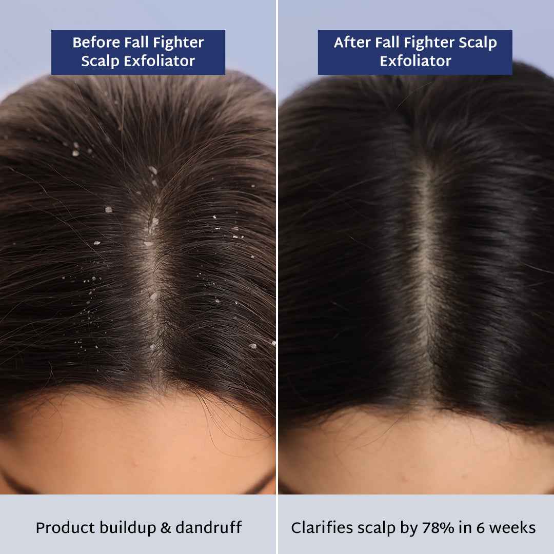 Raise Fall Fighter Scalp Exfoliator | Viral Scalp Detox, Hair Fall & Dandruff Scrub - Raise